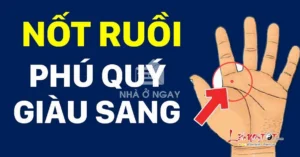 giai-ma-bi-an-not-ruoi-trong-long-ban-tay-van-menh-tinh-duye_746
