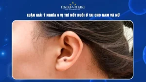 not-ruoi-o-vanh-tai-giai-ma-y-nghia-van-menh-tuong-so-chi-ti_356