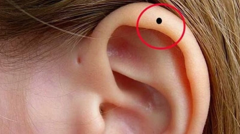 Nốt ruồi ở vành tai thể hiện trí tuệ và khả năng giao tiếp
