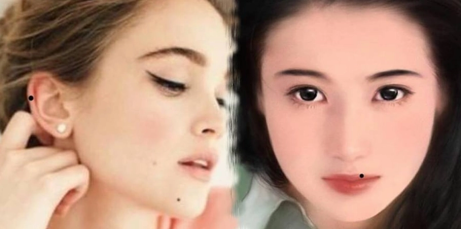 Vị trí nốt ruồi may mắn trên tai nam giới